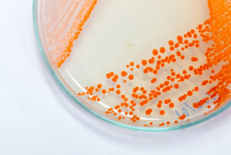 Microbiologie Générale L2